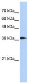 ATPase H+ Transporting V0 Subunit D2 antibody, TA329774, Origene, Western Blot image 