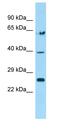 TGFB Induced Factor Homeobox 2 antibody, orb329707, Biorbyt, Western Blot image 