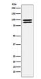 Programmed Cell Death 6 Interacting Protein antibody, M01751, Boster Biological Technology, Western Blot image 
