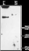 Chloride Voltage-Gated Channel 1 antibody, GTX54773, GeneTex, Western Blot image 