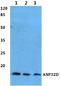 Acidic Nuclear Phosphoprotein 32 Family Member D antibody, A15109, Boster Biological Technology, Western Blot image 