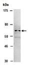 Matrix Metallopeptidase 15 antibody, orb67215, Biorbyt, Western Blot image 