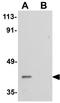 Phospholipid Phosphatase 6 antibody, GTX85222, GeneTex, Western Blot image 