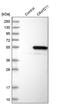 Acidic Residue Methyltransferase 1 antibody, PA5-52211, Invitrogen Antibodies, Western Blot image 
