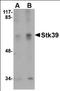 Serine/Threonine Kinase 39 antibody, orb89211, Biorbyt, Western Blot image 