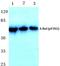 A-Raf Proto-Oncogene, Serine/Threonine Kinase antibody, PA5-36783, Invitrogen Antibodies, Western Blot image 