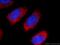 3-ketoacyl-CoA thiolase A, peroxisomal antibody, 12319-2-AP, Proteintech Group, Immunofluorescence image 