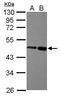 Zinc Finger And BTB Domain Containing 26 antibody, GTX116694, GeneTex, Western Blot image 
