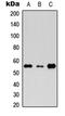 RTKN antibody, LS-C358298, Lifespan Biosciences, Western Blot image 