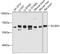 Solute Carrier Family 6 Member 5 antibody, A03349, Boster Biological Technology, Western Blot image 