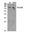 RNA Polymerase III Subunit E antibody, A11932, Boster Biological Technology, Western Blot image 