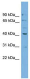 DnaJ Heat Shock Protein Family (Hsp40) Member B12 antibody, TA342339, Origene, Western Blot image 