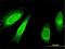 Staufen Double-Stranded RNA Binding Protein 1 antibody, H00006780-M01, Novus Biologicals, Immunocytochemistry image 