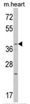 Proto-oncogene Wnt-1 antibody, AP17833PU-N, Origene, Western Blot image 