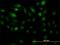 Zic Family Member 4 antibody, H00084107-M07, Novus Biologicals, Immunocytochemistry image 