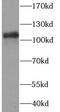 Poly(ADP-Ribose) Polymerase 1 antibody, FNab09939, FineTest, Western Blot image 