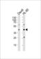 Mitochondrial Calcium Uniporter Dominant Negative Beta Subunit antibody, LS-C156906, Lifespan Biosciences, Western Blot image 