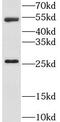 Lecithin retinol acyltransferase antibody, FNab04838, FineTest, Western Blot image 
