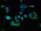 Fermitin family homolog 3 antibody, LS-C677935, Lifespan Biosciences, Immunofluorescence image 