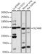 Solute Carrier Family 4 Member 8 antibody, A14825, ABclonal Technology, Western Blot image 