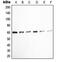 SRC Proto-Oncogene, Non-Receptor Tyrosine Kinase antibody, MBS821259, MyBioSource, Western Blot image 