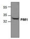 Proto-oncogene serine/threonine-protein kinase pim-1 antibody, GTX59826, GeneTex, Western Blot image 
