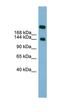 Sucrase-isomaltase, intestinal antibody, orb325188, Biorbyt, Western Blot image 