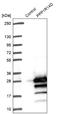 Protein Phosphatase 1 Regulatory Inhibitor Subunit 14D antibody, NBP1-85484, Novus Biologicals, Western Blot image 