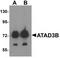 ATPase Family AAA Domain Containing 3B antibody, TA320039, Origene, Western Blot image 