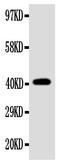 Ectodysplasin A antibody, PA1561, Boster Biological Technology, Western Blot image 