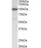 Gelsolin antibody, OAEB02931, Aviva Systems Biology, Western Blot image 