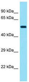 Keratin, type II cytoskeletal 78 antibody, TA337402, Origene, Western Blot image 