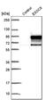 Exocyst complex component 8 antibody, PA5-55617, Invitrogen Antibodies, Western Blot image 