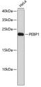 Phosphatidylethanolamine Binding Protein 1 antibody, 13-207, ProSci, Western Blot image 