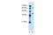 Leucine Rich Repeat Containing 26 antibody, GTX46663, GeneTex, Western Blot image 