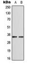 Cyclin Dependent Kinase Like 4 antibody, GTX56042, GeneTex, Western Blot image 