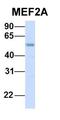 Forkhead Box C1 antibody, orb329956, Biorbyt, Western Blot image 