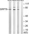 Heat Shock Protein Family A (Hsp70) Member 5 antibody, TA312902, Origene, Western Blot image 