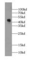 GDP Dissociation Inhibitor 2 antibody, FNab03408, FineTest, Western Blot image 