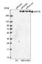 Microtubule Associated Protein 1B antibody, HPA022275, Atlas Antibodies, Western Blot image 