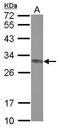 Caseinolytic Mitochondrial Matrix Peptidase Proteolytic Subunit antibody, GTX115070, GeneTex, Western Blot image 