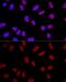 A-Kinase Anchoring Protein 8 antibody, GTX32429, GeneTex, Immunocytochemistry image 