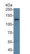 Retinol Binding Protein 3 antibody, LS-C300330, Lifespan Biosciences, Western Blot image 