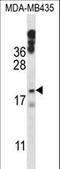Histone Cluster 1 H1 Family Member E antibody, LS-C166886, Lifespan Biosciences, Western Blot image 