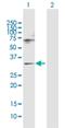 SNF8 Subunit Of ESCRT-II antibody, H00011267-D01P, Novus Biologicals, Western Blot image 