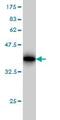 Solute Carrier Family 11 Member 2 antibody, ab55735, Abcam, Western Blot image 