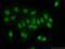 Histone Cluster 1 H1 Family Member C antibody, 15446-1-AP, Proteintech Group, Immunofluorescence image 