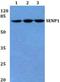 SUMO Specific Peptidase 1 antibody, GTX66632, GeneTex, Western Blot image 