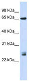 Tripartite Motif Containing 8 antibody, TA345418, Origene, Western Blot image 