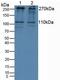 Insulin Like Growth Factor 2 Receptor antibody, MBS2004473, MyBioSource, Western Blot image 